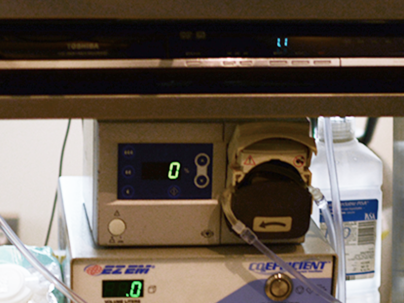 Endoscopic irrigation pump